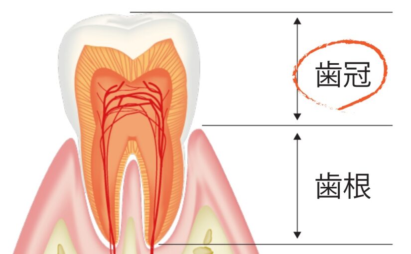【歯の構造】歯冠部編：小さいと思っていたむし歯が実は大きかったりする理由