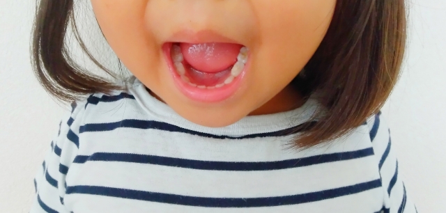 【小児歯科】子供のむし歯を防ぐ方法、「シーラント」とは？