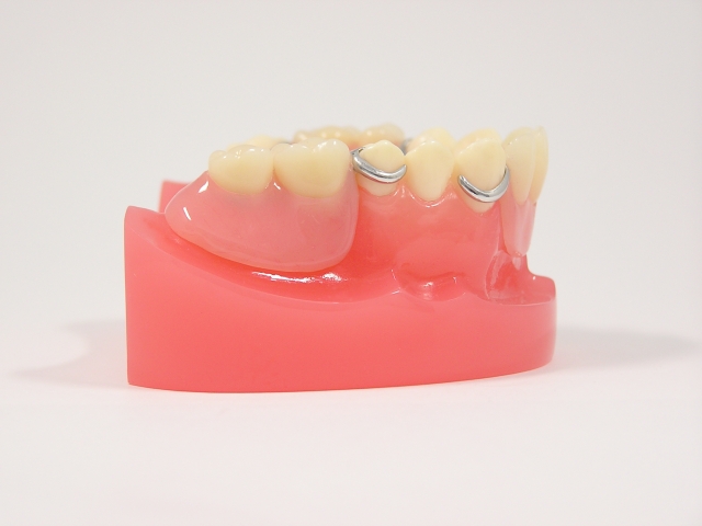 奥歯２本がない時に入れ歯は必要なのか？「短縮歯列」という考え方